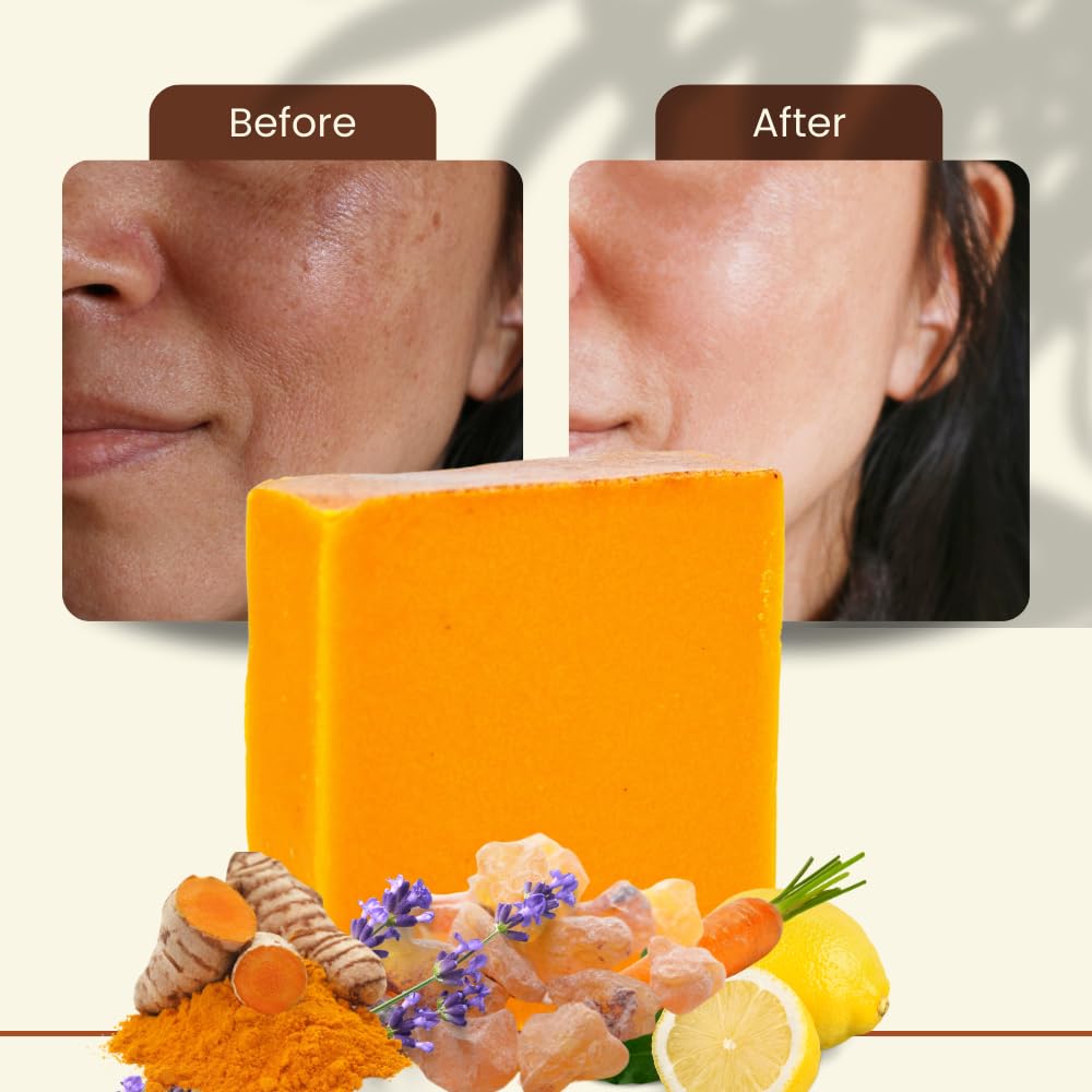 Turmeric Skin Cleansing Soap - Natural Glow Face & Body Cleanser for Acne, Dark Spots & Scars, Gentle for All Skin Types (4.5 oz) 1 bar