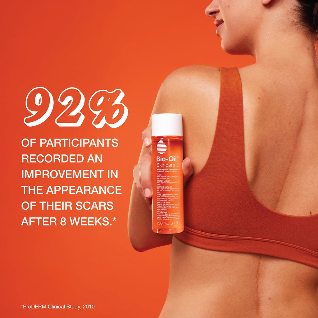 Bio-Oil Skincare Body Oil Serum, Face and Body Moisturizer with Vitamin E & A, for Scars, Stretch Marks, Sensitive Skin, All Skin Types, Dermatologist Recommended, Non-Comedogenic, 6.7 Oz
