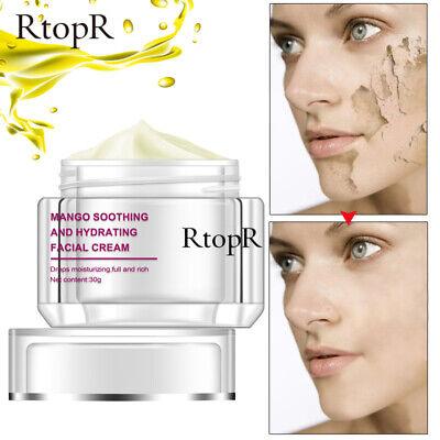 RtopR | Mango Soothing and Hydrating Facial Cream Repair Whitening Nourish - 30g - Better Savings Group