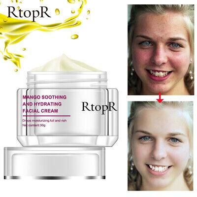 RtopR | Mango Soothing and Hydrating Facial Cream Repair Whitening Nourish - 30g - Better Savings Group