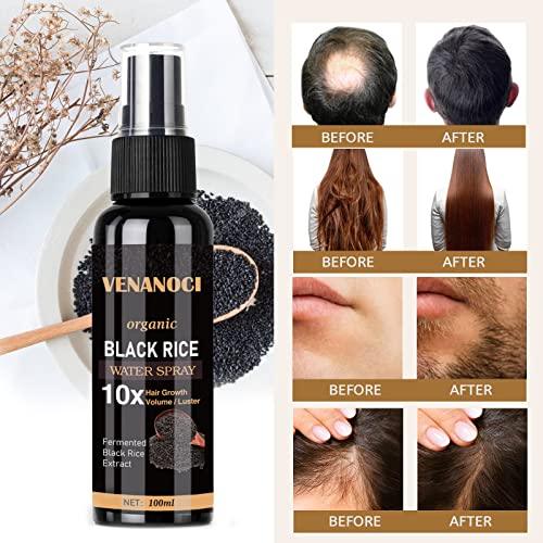 Venanoci Hair Growth Serum, Rice Water for Hair Growth for Women & Men, Hair Loss Treatment, Rice Water Spray for Damaged Dry Hair Treatment, Hair Regrowth Treatment for Thicker Longer Fuller Hair with Castor oil Ginger - Better Savings Group