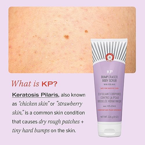 First Aid Beauty KP Bump Eraser Body Scrub Exfoliant for Keratosis Pilaris with 10% AHA – 8 oz