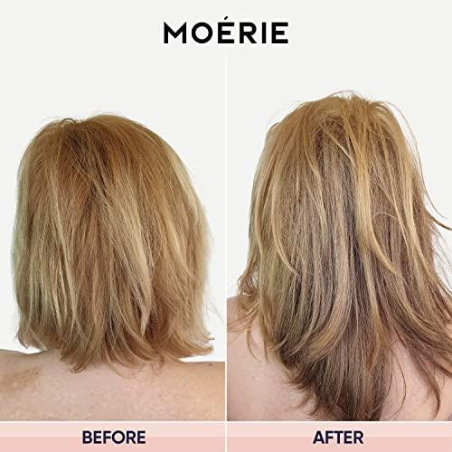 Moerie Ultimate Hair Growth Spray Designed to Strengthen Hair & Stop Hair Loss - 100% Natural Hair Serum for Hair Growth with over 100 Minerals, Vitamins & Amino acids - Fresh Scent - 5.07 Fl. Oz - Better Savings Group