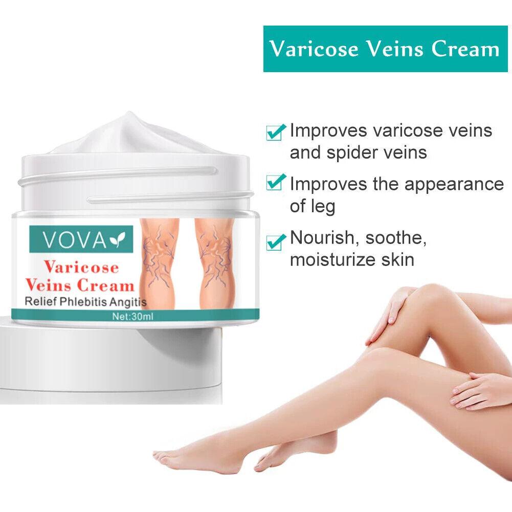 VOVA | Varicose Veins Cream - Reduce Vein Scar Treatment Skin Repair Smooth 30ml - Better Savings Group