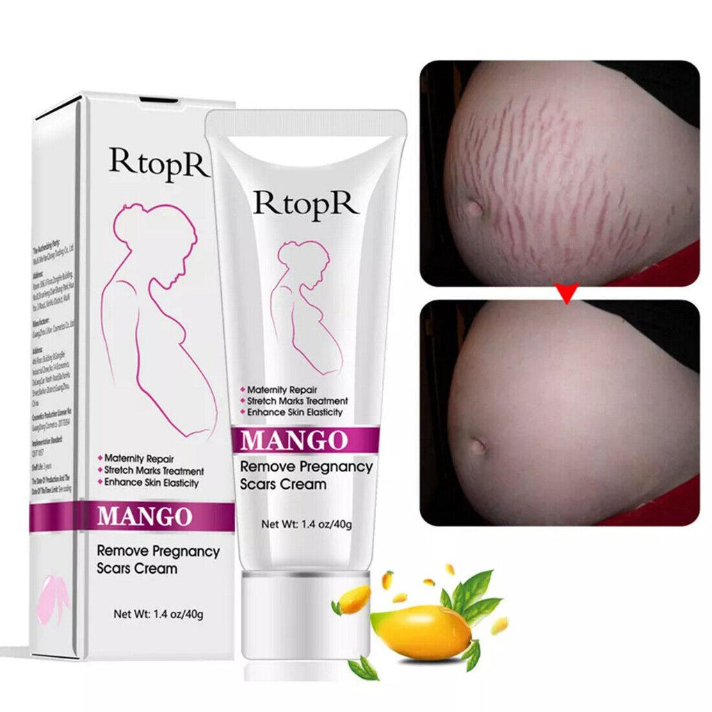 RtopR | Mango Pregnancy Scar Cream Stretch Marks Maternity Repair Firming - 40g - Better Savings Group