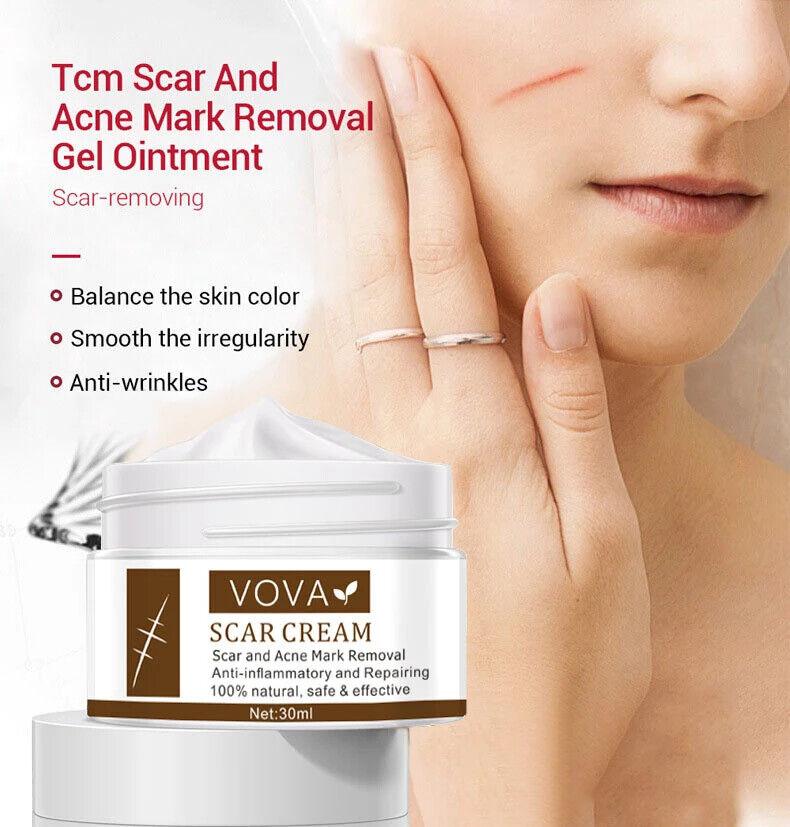 VOVA | Scar Cream - Natural Scar Removal Skin Repair Anti-Inflammatory 30ml - Better Savings Group