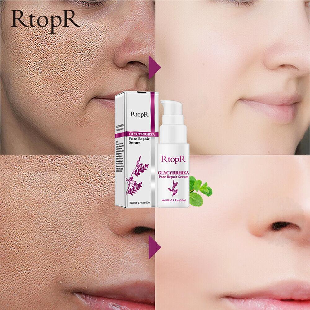 RtopR | Glycyrrhiza Pore Serum Shrink Pore Brightness Smooth Rough Skin - 20ml - Better Savings Group