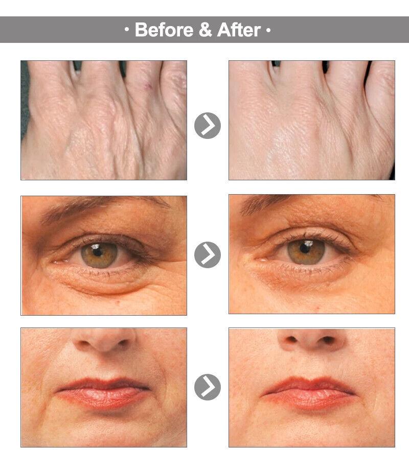 AuQuest 5 Seconds - Your Ultimate Anti-Aging Solution - Firm Wrinkle Skin Tightening & Repair Anti Aging Cream - 20g - Better Savings Group