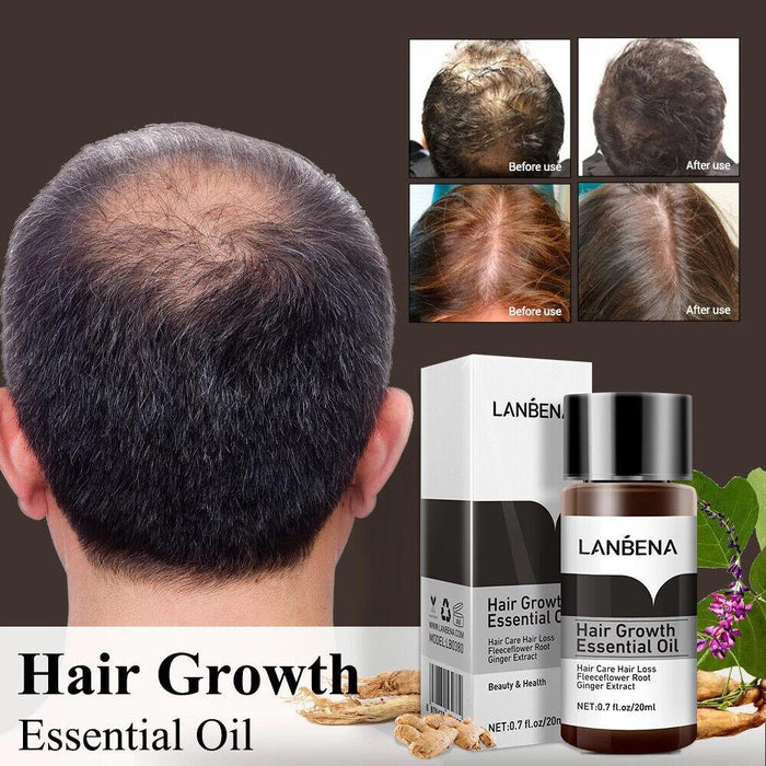 LANBENA | Hair Growth Care Essence Oil Fast Growing Hair on Head in 2 Weeks - 20ml - Better Savings Group