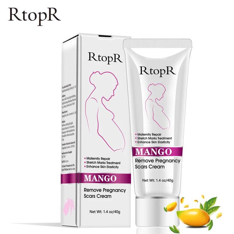 RtopR | Mango Pregnancy Scar Cream Stretch Marks Maternity Repair Firming - 40g - Better Savings Group