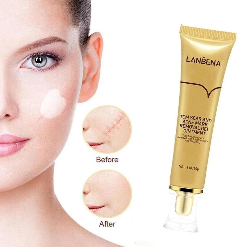 LANBENA | Skin Care Gel with TCM - Scar & Acne Mark Removal Gel Ointment - 30g - Better Savings Group