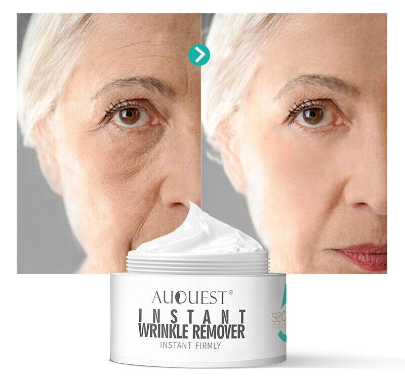 AuQuest 5 Seconds - Your Ultimate Anti-Aging Solution - Firm Wrinkle Skin Tightening & Repair Anti Aging Cream - 20g - Better Savings Group