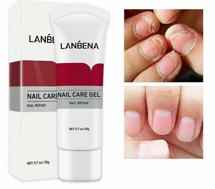 LANBENA | Fungal Nail Treatment Onychomycosis Remove Nail Repair Gel Serum 20g - Better Savings Group