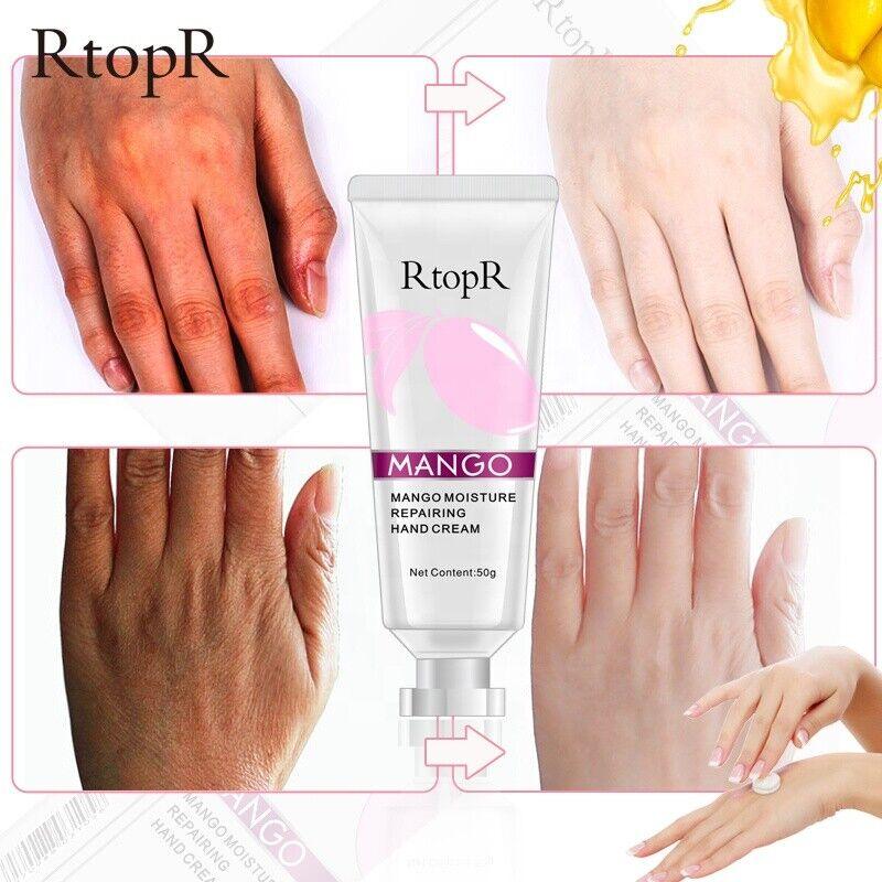 RtopR | Mango Moisture Deep Repairing Hand Cream High Quality Scab Scar Dry- 50g - Better Savings Group