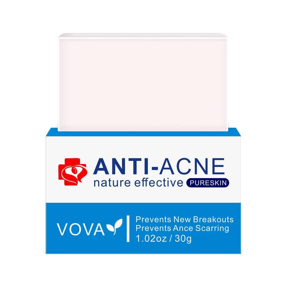 VOVA | Anti-Acne Nature Effective Pure Skin - Acne Soap Bar for Breakouts Scarring - Better Savings Group