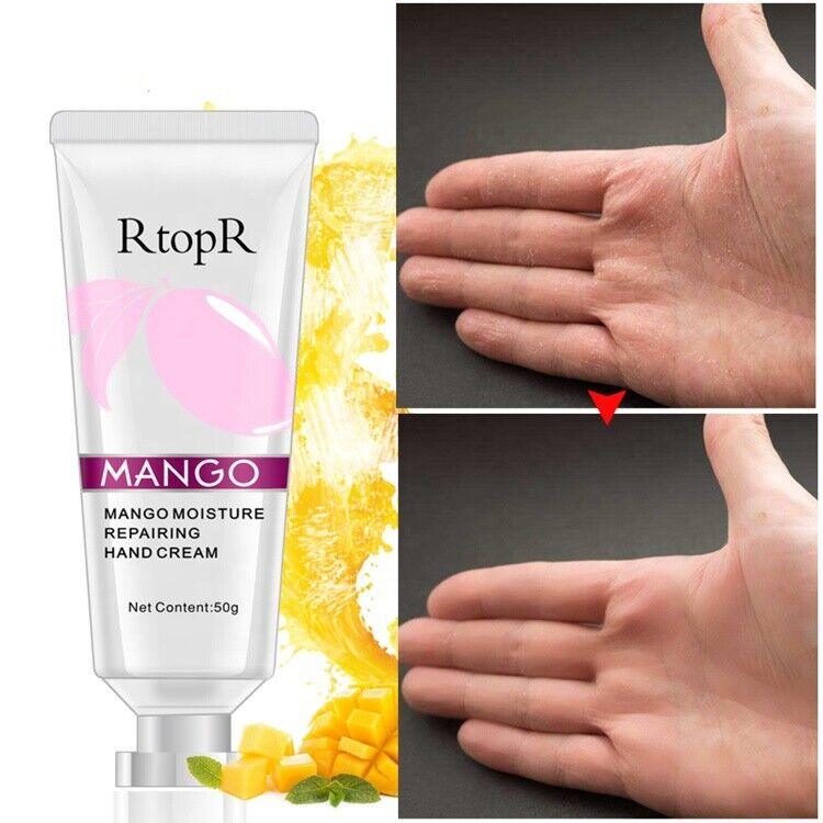 RtopR | Mango Moisture Deep Repairing Hand Cream High Quality Scab Scar Dry- 50g - Better Savings Group