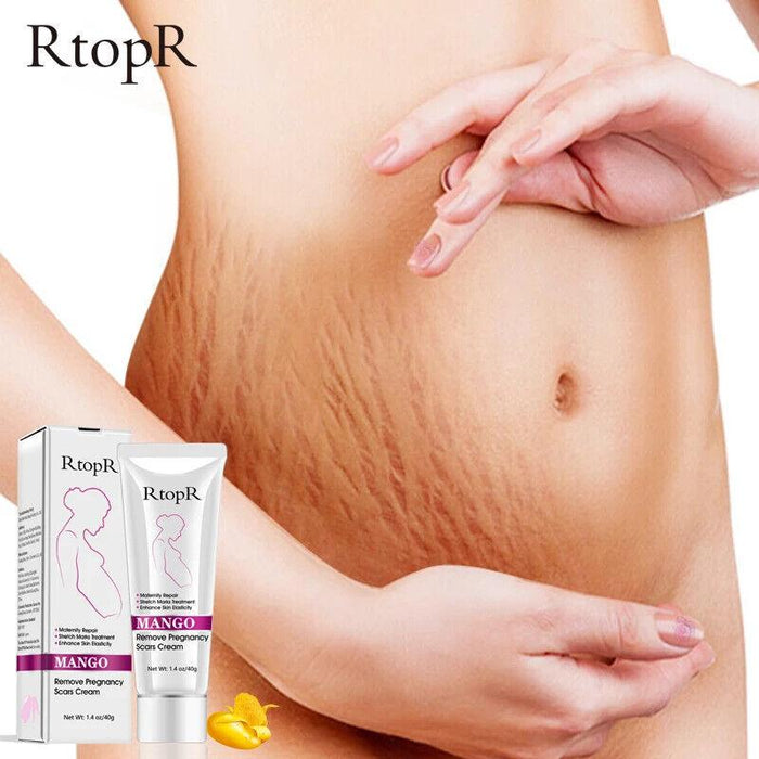 RtopR | Mango Pregnancy Scar Cream Stretch Marks Maternity Repair Firming - 40g - Better Savings Group