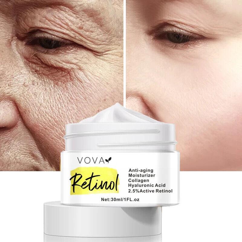 VOVA | 2.5% Retinol Cream - Fine Line Wrinkle Remover Fast With Collagen 30ml - Better Savings Group