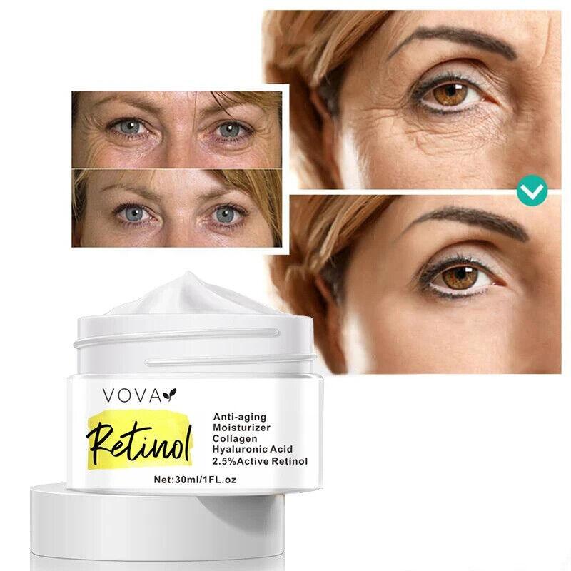 VOVA | 2.5% Retinol Cream - Fine Line Wrinkle Remover Fast With Collagen 30ml - Better Savings Group