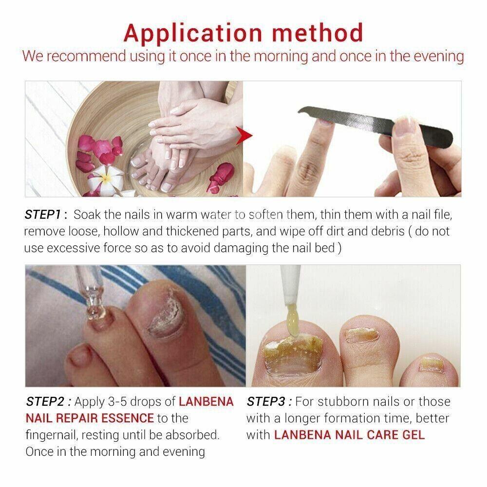 LANBENA | Fungal Nail Treatment Onychomycosis Remove Nail Repair Gel Serum 20g - Better Savings Group