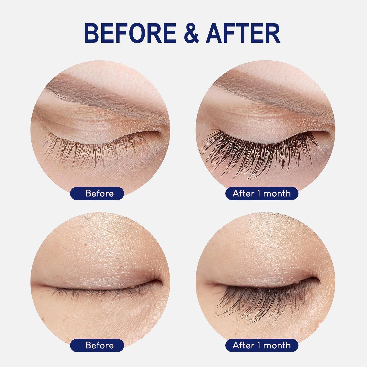 What Makes Your Eyelashes Grow - Lash Serum