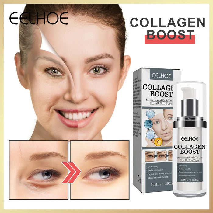 Eelhoe Collagen Boost - Your Fountain of Radiant Skin - Better Savings Group