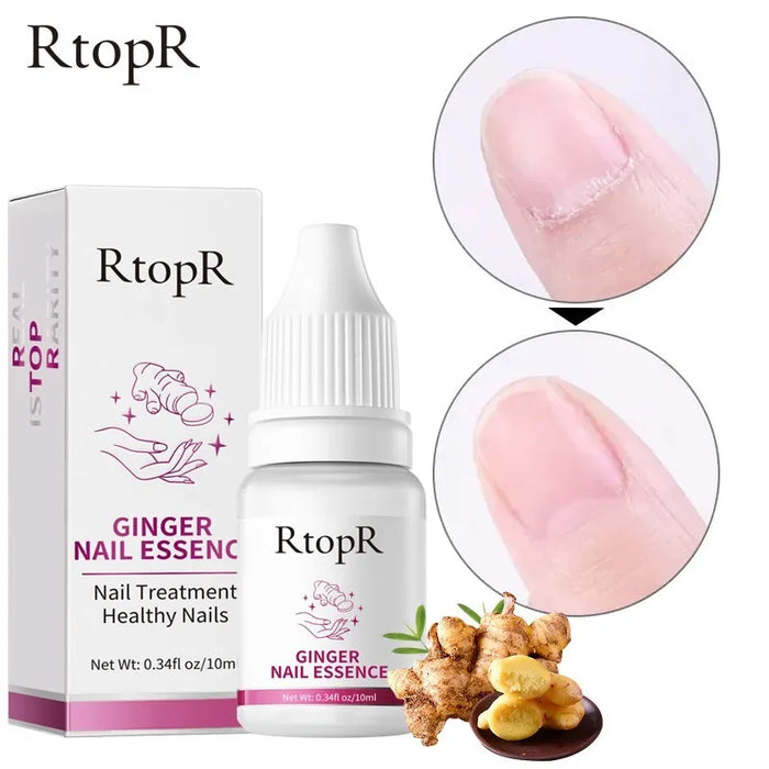 RtopR | Ginger Nail Essence Antibacterial Kill Fungus Repair Essential Oil - 10ml - Better Savings Group